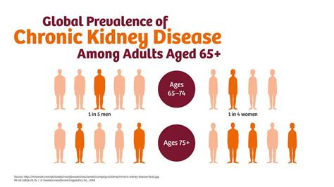 ckd news chanel|latest news on kidney failure.